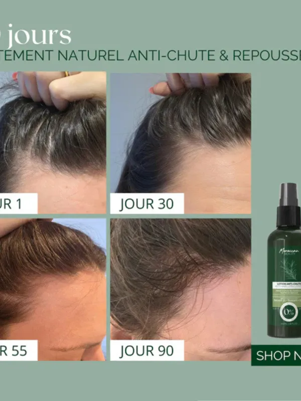 Lotion-Naturelle-Anti-Chute-100-ML-Moroccan-Beauty