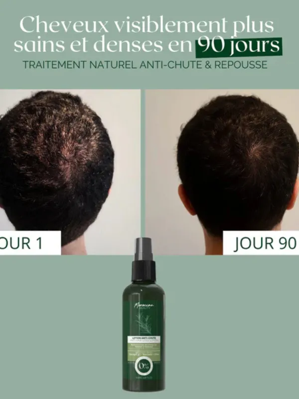 Lotion-Naturelle-Anti-Chute-100-ML-Moroccan-Beauty